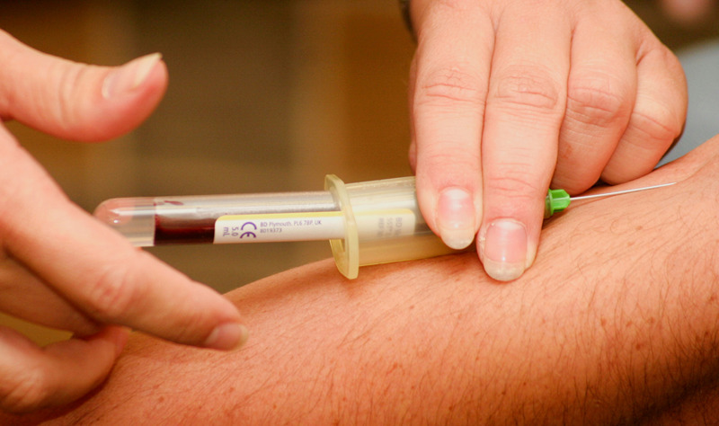 ACP/Eigenbluttherapie (PRP)