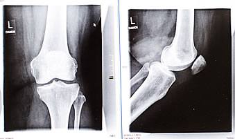 Digitale Röntgendiagnostik